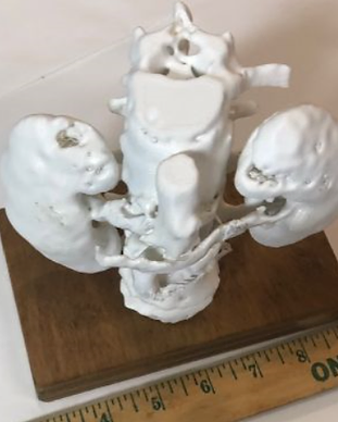 Kidneys-Aorta-Spine Assembly